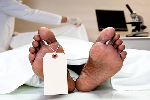 Auxiliar de Necropsia