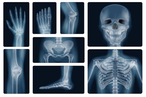 Osteologia Humana