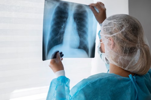 Pneumologia Básica