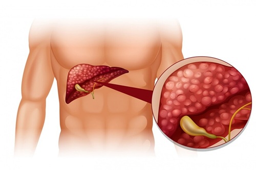 Doenças Hepáticas