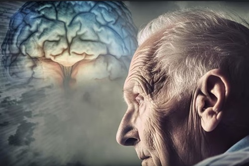 Doenças Neurodegenerativas