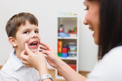 Motricidade Orofacial