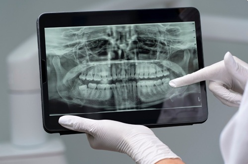 Radiografia Digital