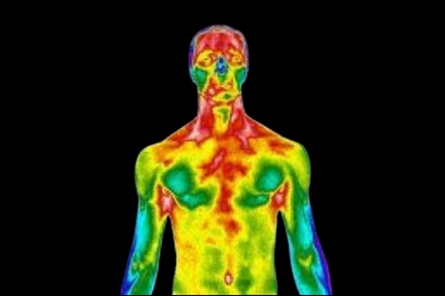 Termografia Clínica