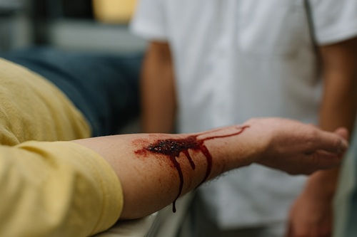 Procedimentos em Pacientes com Hemorragias